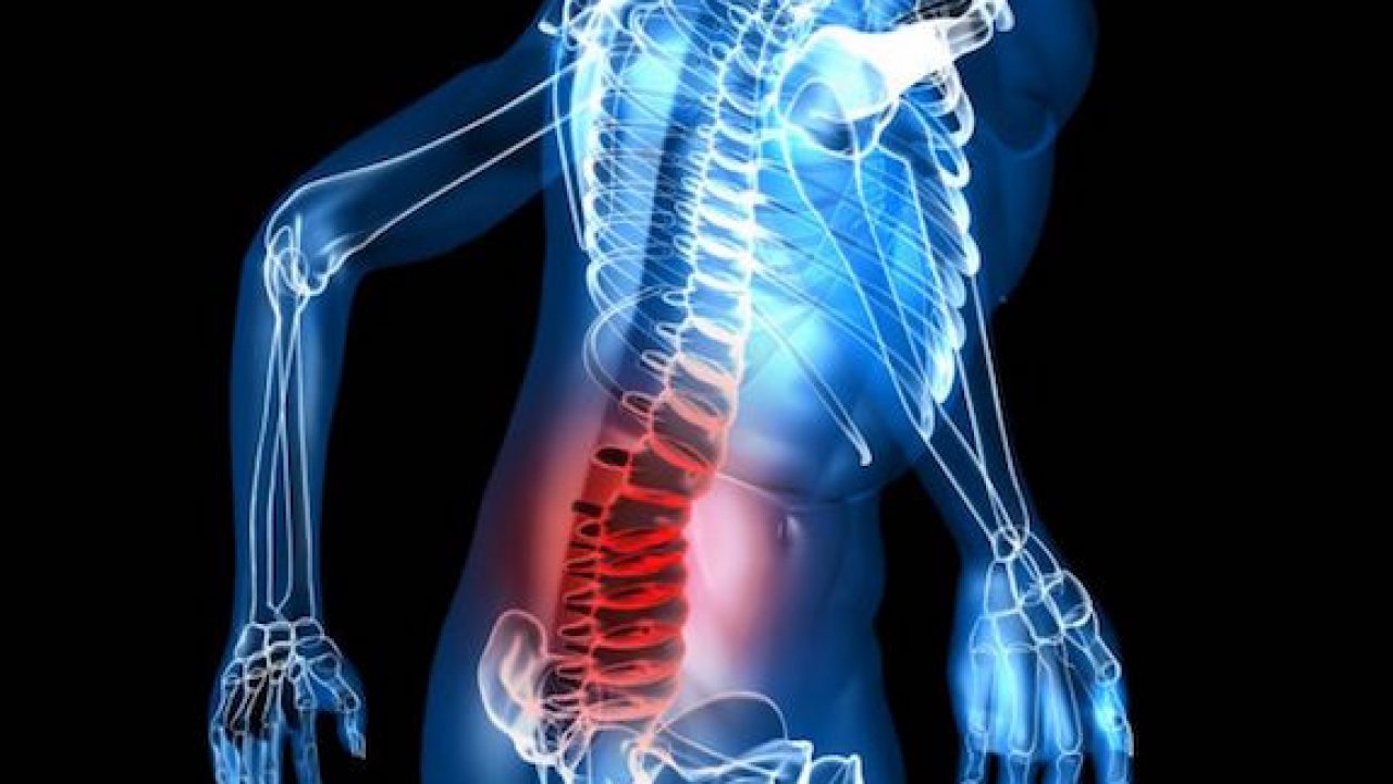 Lesiones de espalda: ¿Cuáles son las más comunes? - Neurocirugía